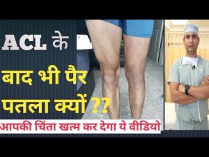 ACL सर्जरी के बाद भी पैर पतला क्यों? / अपने पैर को आप मोटा कैसे करे सर्जरी के बाद ?