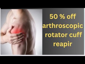 Rotator cuff treatment arthroscopy se 50 % discount me