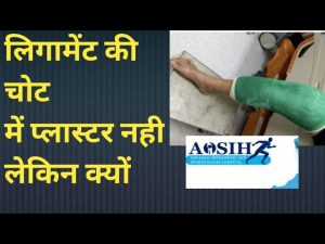 लिगामेंट इंजरी में प्लास्टर कभी ना लगवाए लेकिन क्यों? (how to do best knee ligament management )