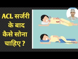 ACL सर्जरी के बाद कैसे सोना चाहिए / करवट कैसे लेना चाहिए / Knee ब्रेस कैसे लगाये और कैसे हटाना ?