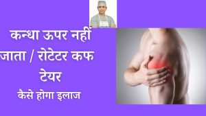 Rotator Cuff ka tear ho illaz kaise hoga/ best dr for rotator cuff in india / most affordable