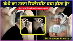 Reverse shoulder complete information hindi me / cost of reverse shoulder