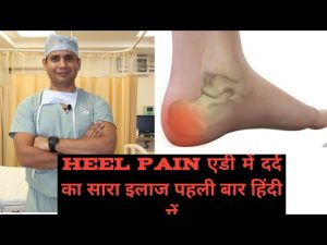 best and complete information on #heelpain #planterfasciitis ( एड़ी में दर्द का पूरा इलाज कैसे करे)