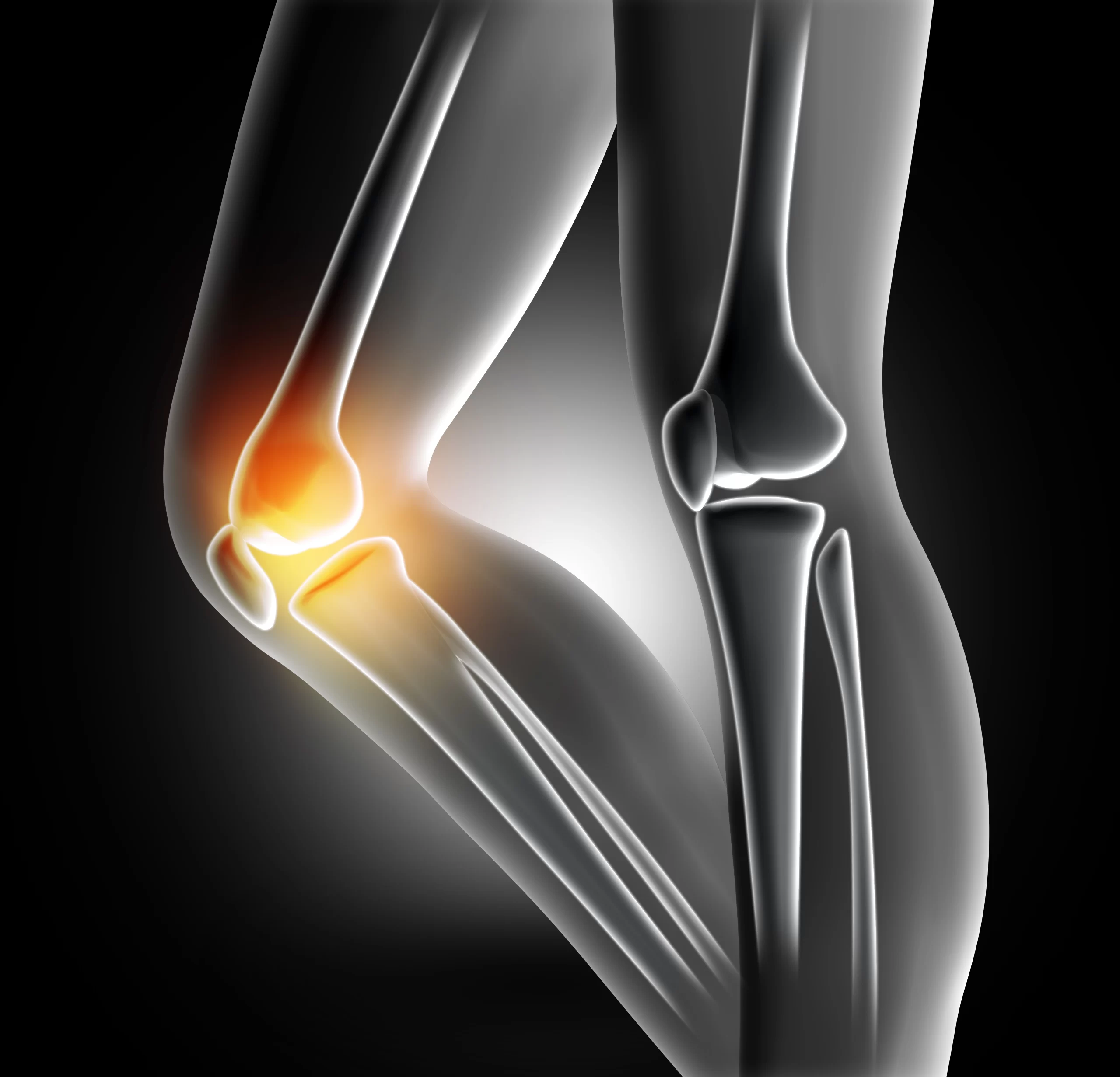 pain-knee-joint-scaled.webp