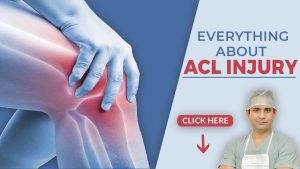 Everything about ACL in hindi 2021 complete Best and latest (घुटने की नस / लिगामेंट का टूटना )