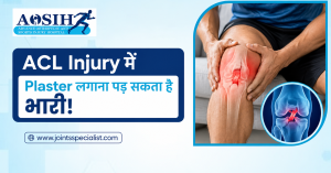 ACL Injury में Plaster लगाना पड़ सकता है भारी!